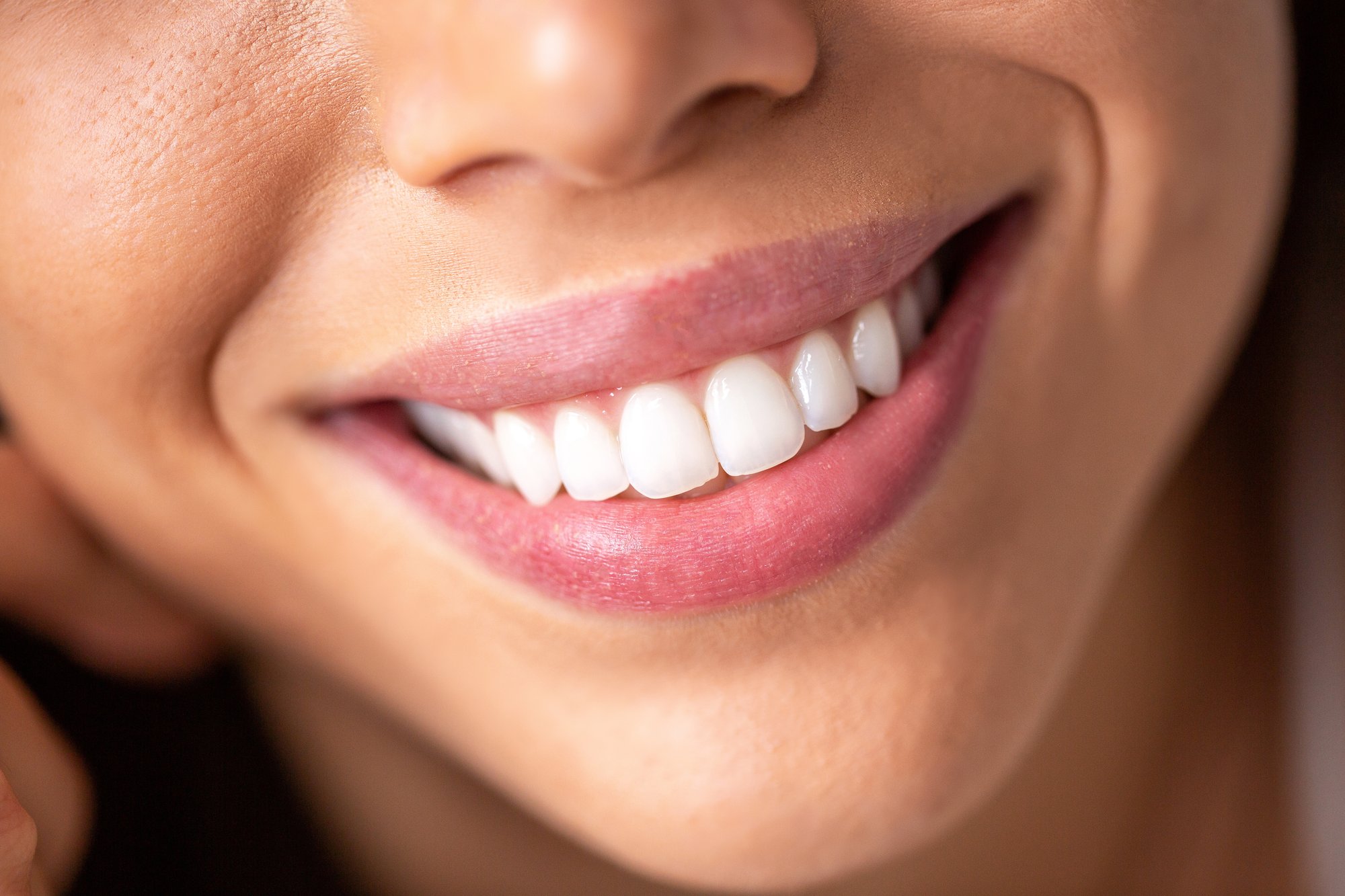 Why Won't My Teeth Get Whiter at Home?